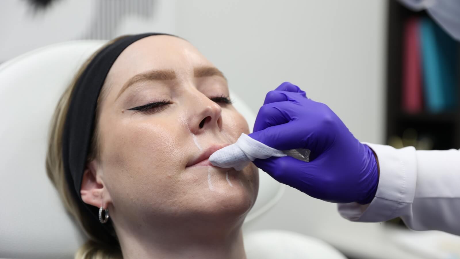 Lip filler numbing being applied