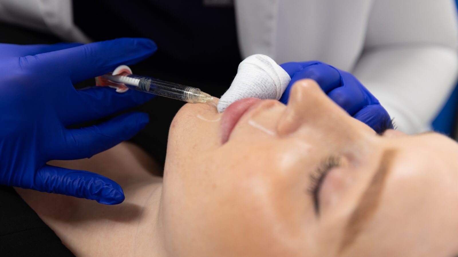 Person recieving lip filler