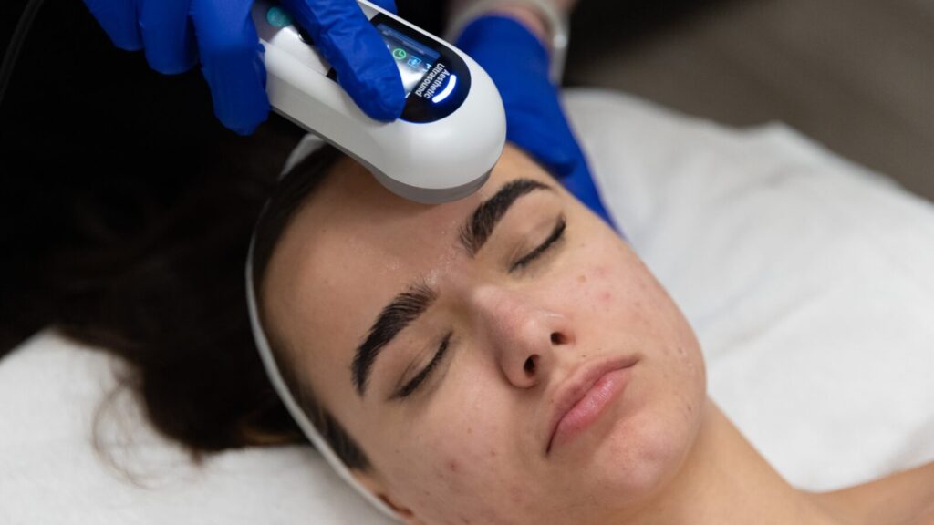 Person getting the SalfFacial