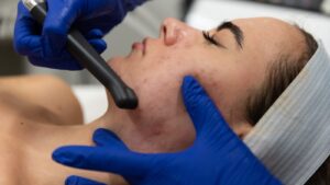 Saltfacial treatment