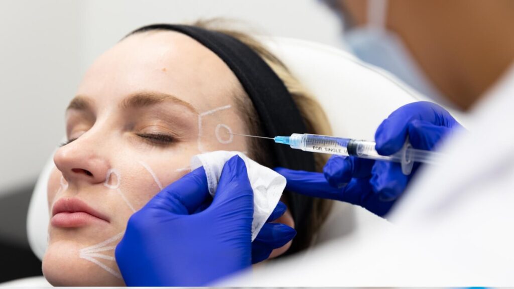 Patient recieving a Sculptra injection to the temple