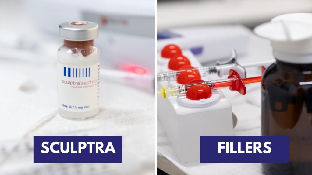 Sculptra versus fillers graphic