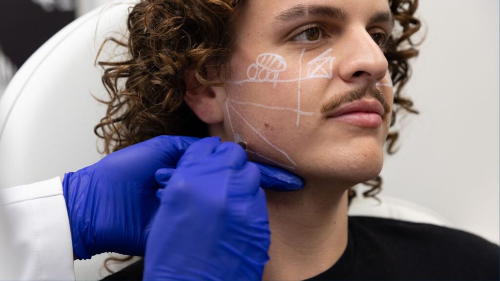 A person getting prepped for injections by getting their face marked