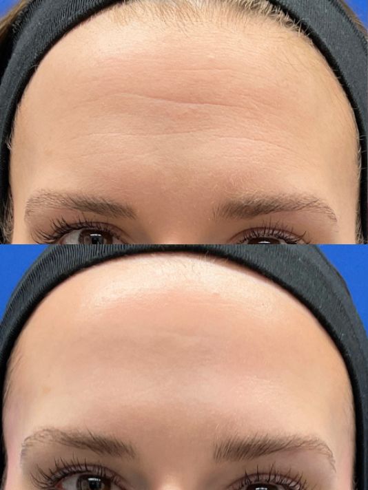 Preview Image for Daxxify