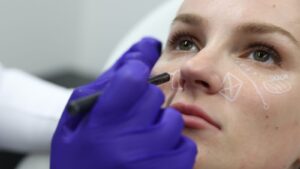 Person getting marked up for treatment