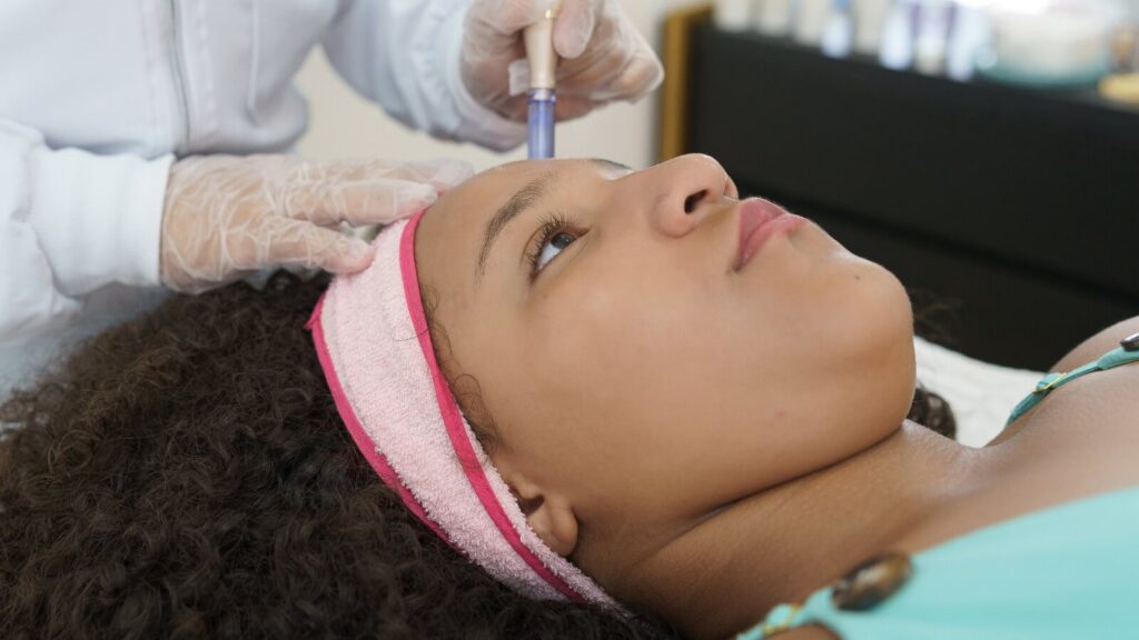 Patient recieving microneedling closeup