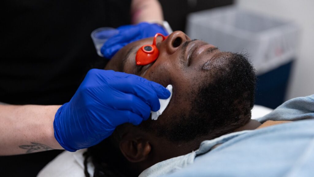 Male getting a chemical peel treatment on his cheek