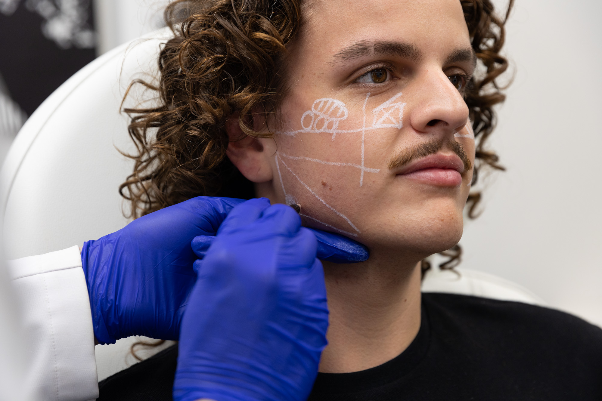 male getting prepped for jawline filler