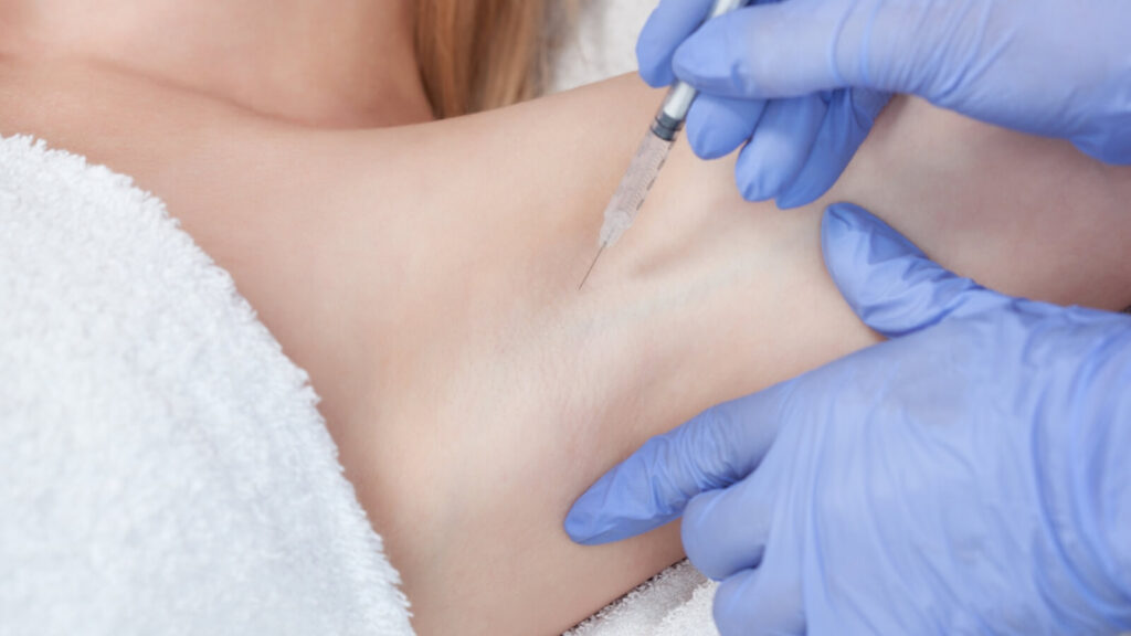 up close of underarm receiving botox