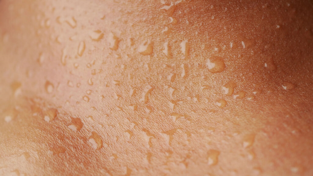 closeup of sweat on the skin