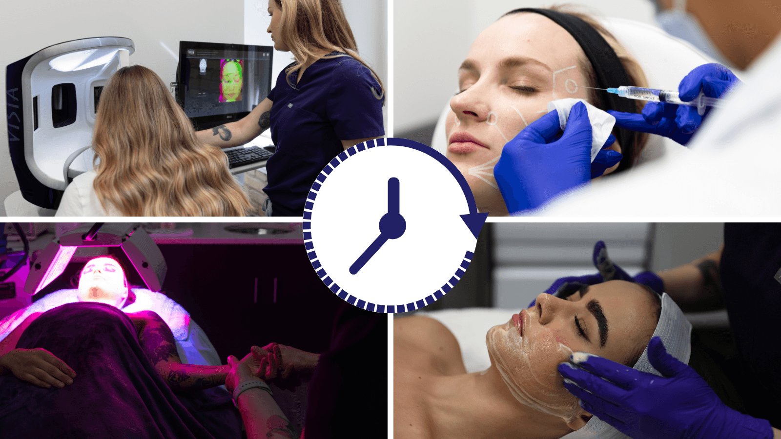 collage of four wedding skin prep with clock overlay